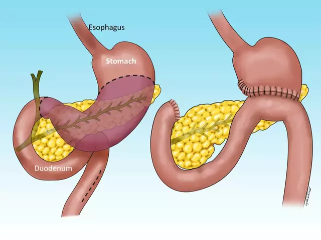 The Importance of Regular Checkups for Atrophic Gastroenteritis Patients